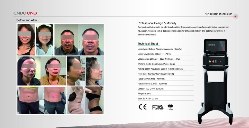 Dual-Wavelength Endolaser for Medical Aesthetics: ENDO ONE’s Selectable Modes and Precise Tissue Targeting